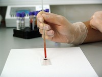 Mnohočetný myelom